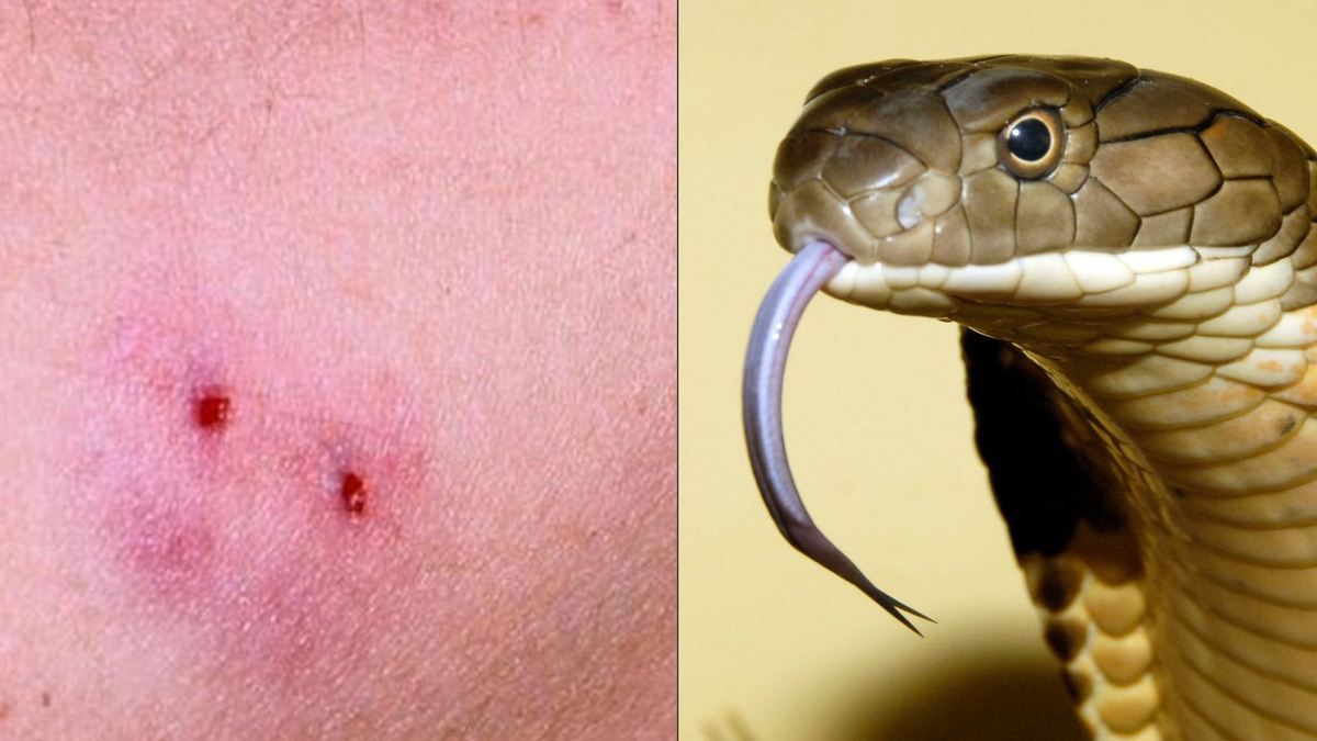 Nọc rắn hổ mang chứa nhiều chất độc và có thể gây ra nhiều vấn đề sức khỏe cho con người, bao gồm liệt tứ chi, suy thận, suy hô hấp, rối loạn nhịp tim, viêm cơ tim và thậm chí có thể gây tử vong.