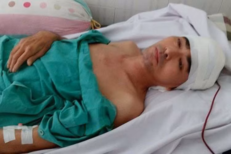 Tháng 4/2017, Nguyễn Hoàng nhập viện trở lại vì khớp háng và khớp gối của anh đã bị vôi hóa thành những khối lớn. Ảnh: Dân Việt