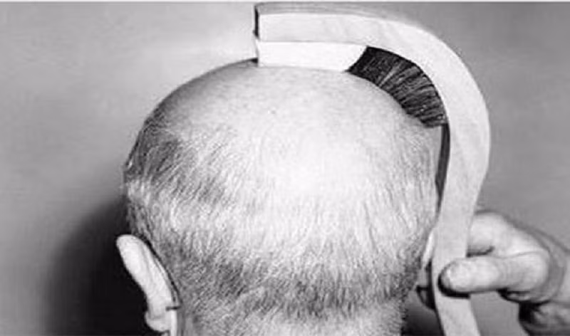 Người bị hói đầu rất được quan tâm, ngoài các loại thuốc kích thích mọc tóc, họ có được những nhà sáng chế đặc biệt làm riêng cho một chiếc lược chải đầu kỳ quặc nhưng khá phù hợp. Nguồn: Lolwot