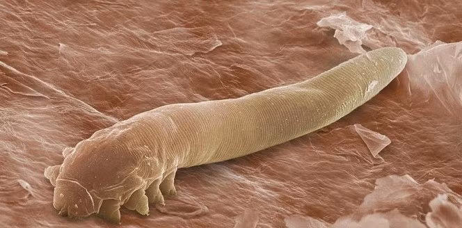 Demodex chỉ dài khoảng 1/3mm, chúng thường được tìm thấy làm tổ trong lông mày, lông mi và chân tóc và các lỗ chân lông khác trên khuôn mặt của con người. (Nguồn Boredom Therapy)