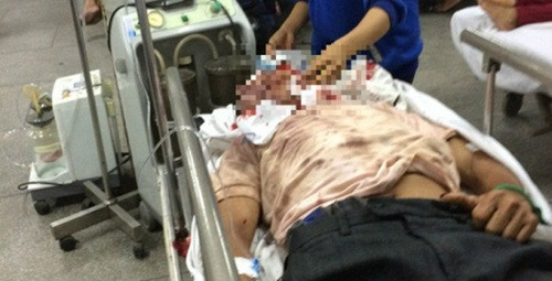 Mau thuan vi dau trau, nguoi dan ong bi vay danh hoi dong