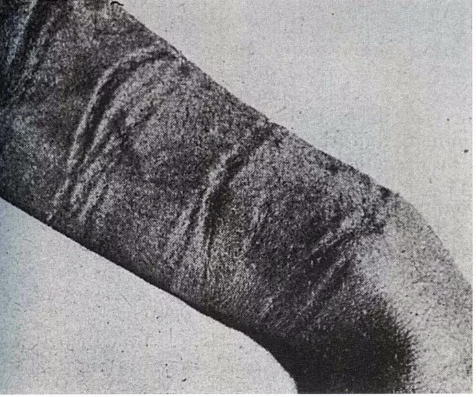 Dấu vết trên tay cô giống như vết trói bằng dây thừng, cho thấy sự trùng khớp giữa câu chuyện của cô và các sự kiện lịch sử.