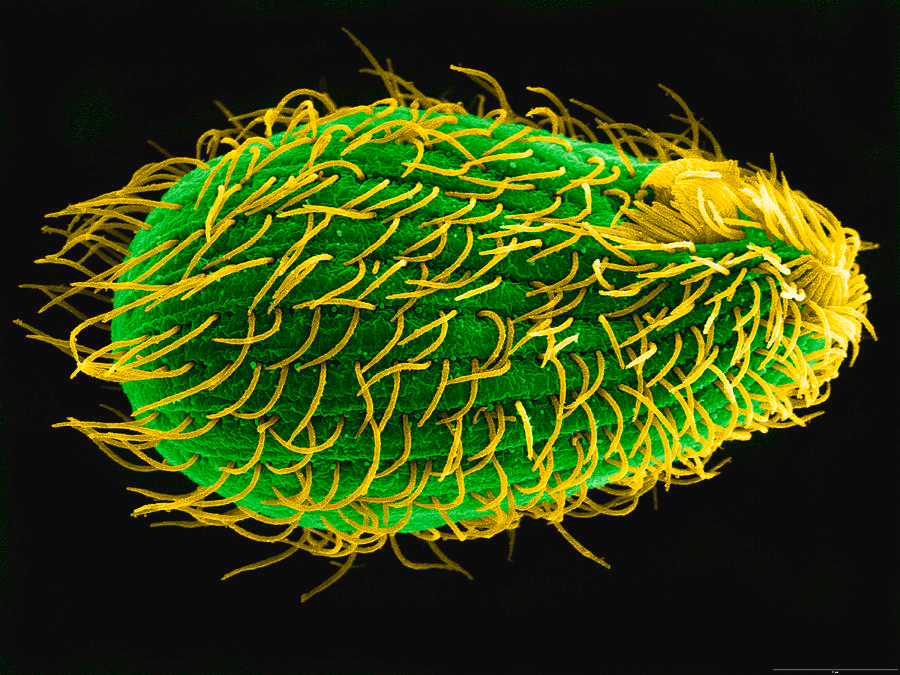 Khi giao phối, có 7 loại gene ghép cặp quy định giới tính, dẫn đến việc thế hệ sau có thể có tới 7 giới tính khác nhau.