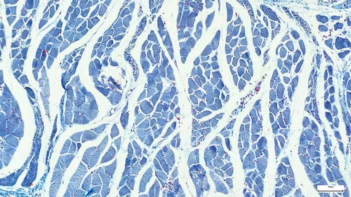 Leonardo da Vinci cũng đặt giả thuyết rằng những dải cơ này giống như hệ thống chúng ta sử dụng để giữ vỉa hè và đường đi không bị đóng băng, nhưng trong trường hợp này là một hệ thống lưu thông máu.