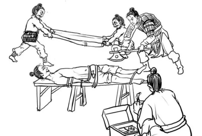 Các dấu hiệu trên xương chứng tỏ việc cắt chi được thực hiện bằng kỹ thuật y tế.