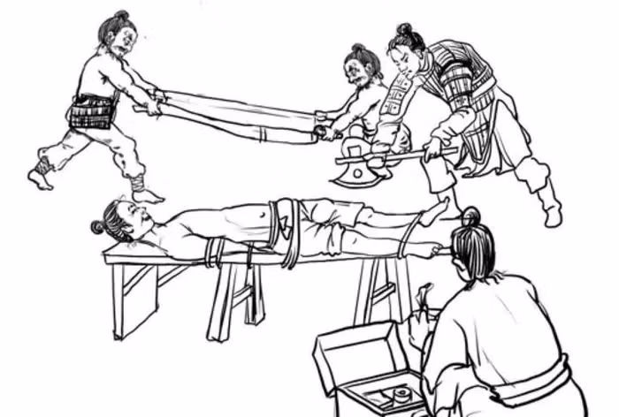 Các dấu hiệu trên xương chứng tỏ việc cắt chi được thực hiện bằng kỹ thuật y tế.