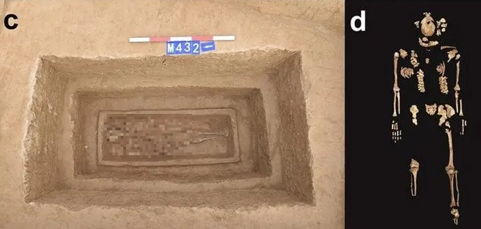 Tuy nhiên, tục lệ này dường như không bị xóa bỏ hoàn toàn, bằng chứng là một bộ xương từ triều đại nhà Thanh (1644-1911) cũng bị cưa bỏ cả hai chân.