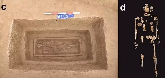 Tuy nhiên, tục lệ này dường như không bị xóa bỏ hoàn toàn, bằng chứng là một bộ xương từ triều đại nhà Thanh (1644-1911) cũng bị cưa bỏ cả hai chân.