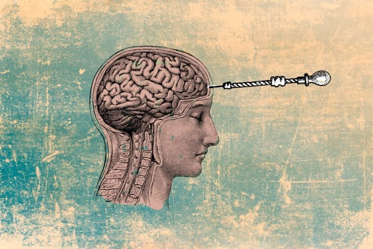 Phương pháp chữa bệnh rùng rợn này được người dân ở Hy Lạp, châu Phi, Mỹ... sử dụng. Họ dùng những công cụ thô sơ để thực hiện ca phẫu thuật hộp sọ nguy hiểm.