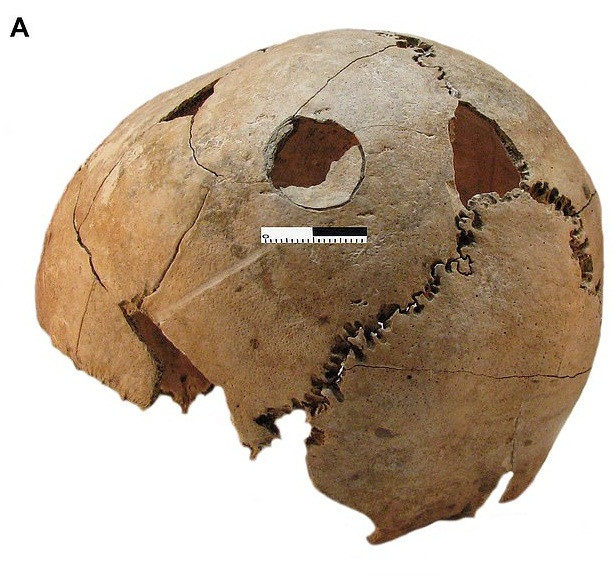 Tất cả những người này qua đời cùng một thời điểm. Căn cứ vào tình trạng các bộ hài cốt, các chuyên gia đi đến kết luận những người này là nạn nhân của một cuộc thảm sát đẫm máu hơn 6.000 năm trước.