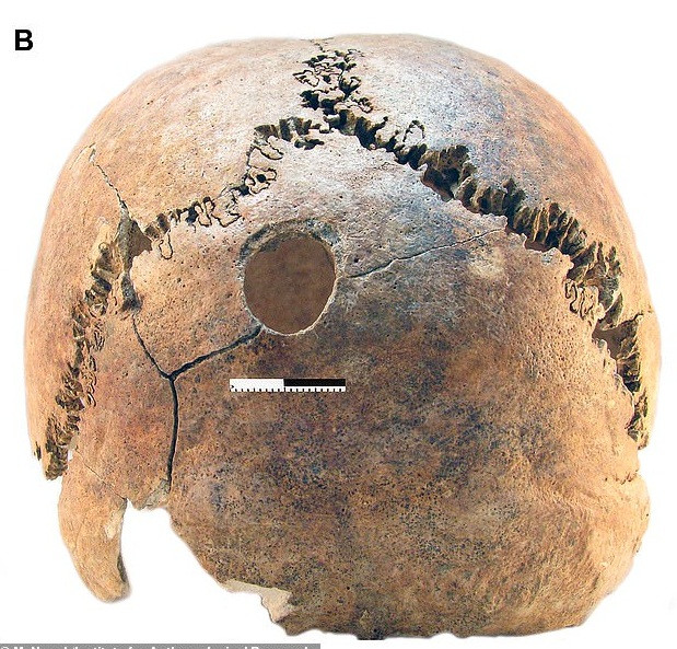 Ngoài 41 bộ hài cốt, các chuyên gia còn tìm thấy một số mảnh đồ gốm. Từ đây, các chuyên gia xác định chúng thuộc nền văn hóa Lasinja.