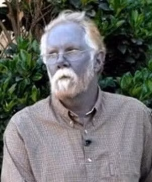 Khi ấy, Hemoglobin sẽ chuyển thành methemoglobin và không còn khả năng vận chuyển oxy. Khi methemoglobin trong hồng cầu lớn hơn 1%, thì sẽ tạo ra methemoglobinemia. Lúc này, da của người thiếu oxy sẽ chuyển sang màu xanh, môi tím và máu có màu chocolate sữa.