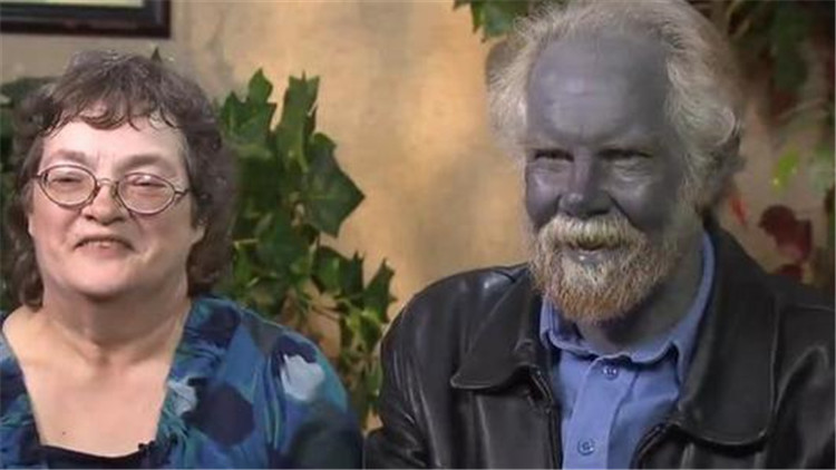 Do đó, ông Cawain tiến hành tiêm một mũi methylene màu xanh cho người da xanh khiến màu da của họ giống với mọi người. Dù vậy, tác dụng của methylene chỉ là tạm thời nên họ phải thường xuyên dùng thuốc.