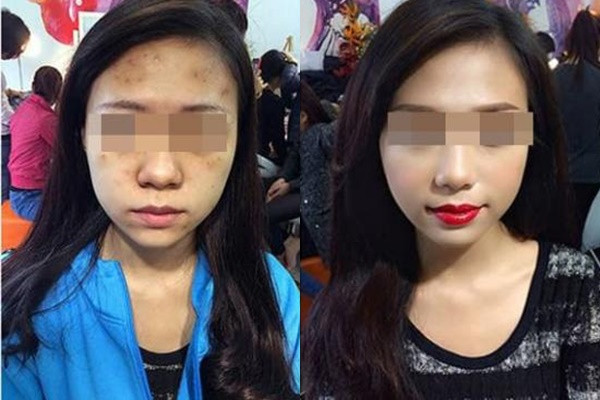 Chang trai muon chia tay ngay lap tuc khi thay mat moc ban gai-Hinh-2