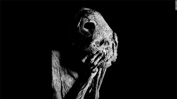 Hẳn khi xưa, người đàn ông này đã từng là một chiến binh dũng mãnh. Đầu ông vẫn tồn tại một lỗ khoan rất lớn, đó là dấu vết của việc chữa trị cho những chiến binh bị thương ở đầu thời xưa