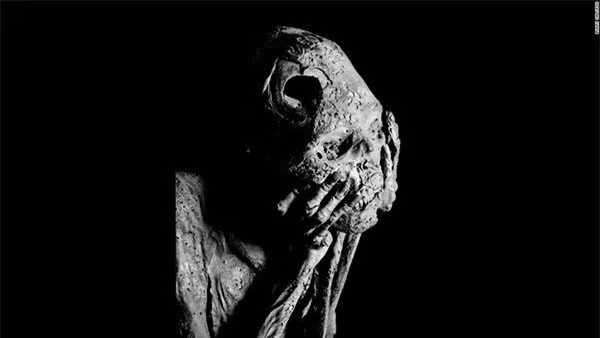 Hẳn khi xưa, người đàn ông này đã từng là một chiến binh dũng mãnh. Đầu ông vẫn tồn tại một lỗ khoan rất lớn, đó là dấu vết của việc chữa trị cho những chiến binh bị thương ở đầu thời xưa