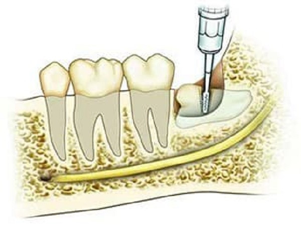 Tai sao khong the nho het rang khon cung mot luc?-Hinh-3