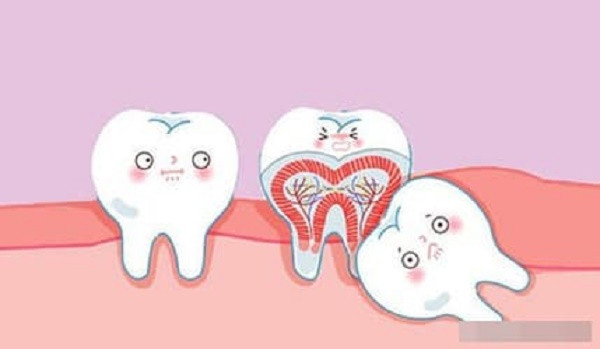 Tai sao khong the nho het rang khon cung mot luc?