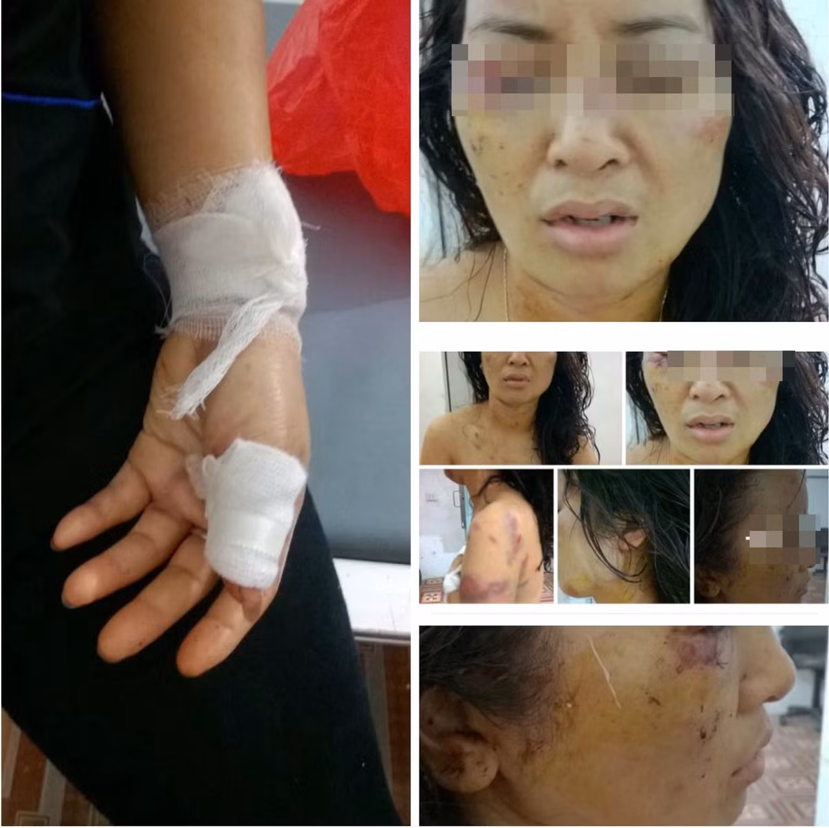 Những vết thương tích trên cơ thể nạn nhân khiến dư luận rúng động.