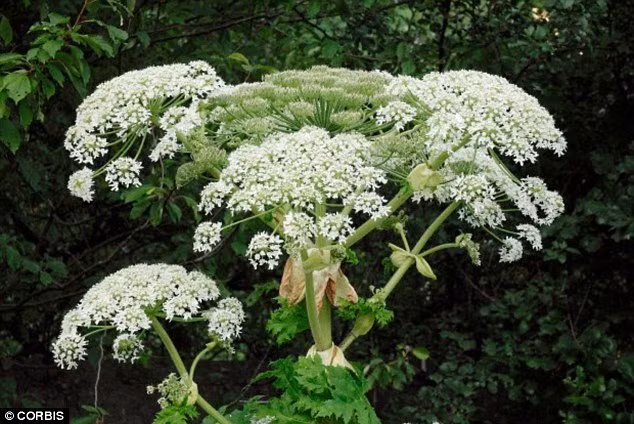 Thậm chí, các bác sỹ còn cho biết, có thể anh sẽ bị thối chân hoàn toàn và không thể để chân tiếp xúc dưới ánh nắng mặt trời trong 7 năm tới vì ánh nắng mặt trời sẽ làm những vết thương phồng rộp thêm.