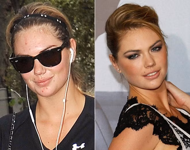 Gương mặt đầy mụn của người mẫu áo tắm Kate Upton khi không được "ngụy trang" bằng lớp son phấn bên ngoài.