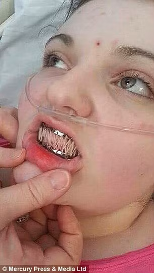 Căn bệnh lạ này khiến cho sinh hoạt của cô bé vô cùng khó khăn, Emily không thể ngồi học bài vì khớp sẽ rơi khi cô bé ngồi xuống bàn. Hoặc đôi khi đang đi, các khớp trượt ra khiến cho cô bé đổ sụp xuống sàn nhà. Quai hàm thì thường xuyên bị trẹo và bàn chải răng mắc kẹt trong miệng là tai nạn xảy ra thường xuyên.