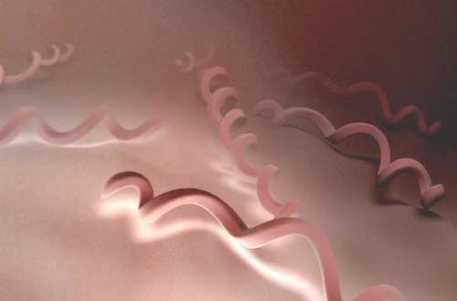 Giang mai ở người lớn. Người lớn chủ yếu mắc bệnh giang mai qua quan hệ tình dục không an toàn với người bệnh. Xoắn khuẩn Treponema pallidum xâm nhập vào cơ thể người rồi gây bệnh giang mai. Giang mai có 3 thời kỳ: