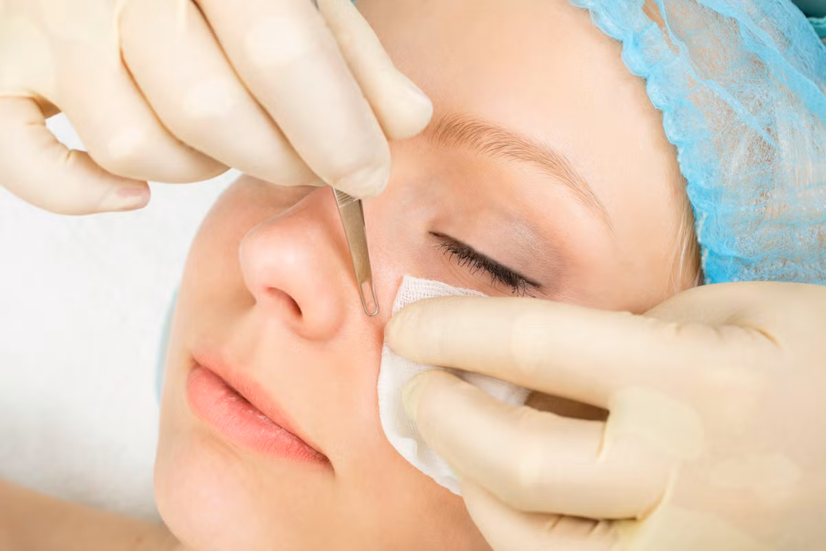 Nặn hút mụn. Nếu bạn thường xuyên nặn hút mụn thì nên dừng ngay thói quen khiến da nhăn nheo này lại. Bất cứ khi nào bạn nặn, sử dụng các chất hút mụn hoặc kéo căng da mặt, bạn đã gây ra những tác động khiến da mặt bị tổn thương, gây kích ứng da, thậm chí sẽ để lại sẹo và các nếp nhăn trên da. Ảnh: topsante.com.