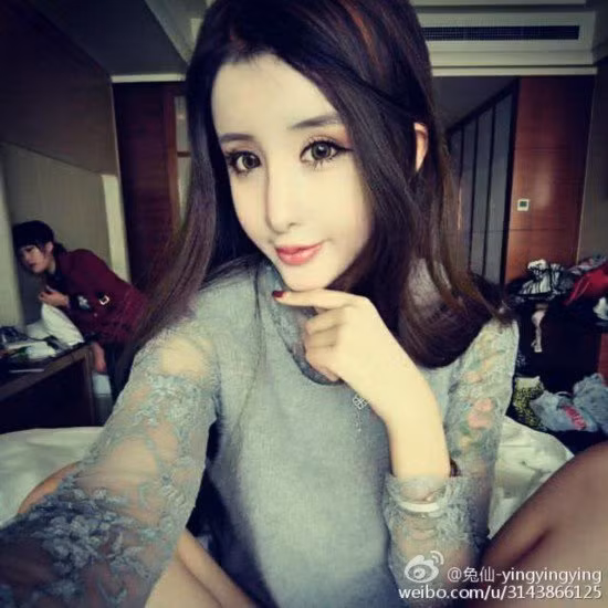 Một cô gái 15 tuổi ở Bắc Kinh (Trung Quốc) có nickname là Lee Hee Danae khiến bạn bè cô cũng phải kinh ngạc với khuôn mặt mới. Dân mạng cho rằng cô đã thẩm mỹ và trang điểm quá nhiều khiến khuôn mặt nhọn hoắt và làn da trắng nhợt nhạt. Nhìn hình ảnh ngày, rất nhiều người cảm thấy tiếc nuối cho nhan sắc của cô bé.