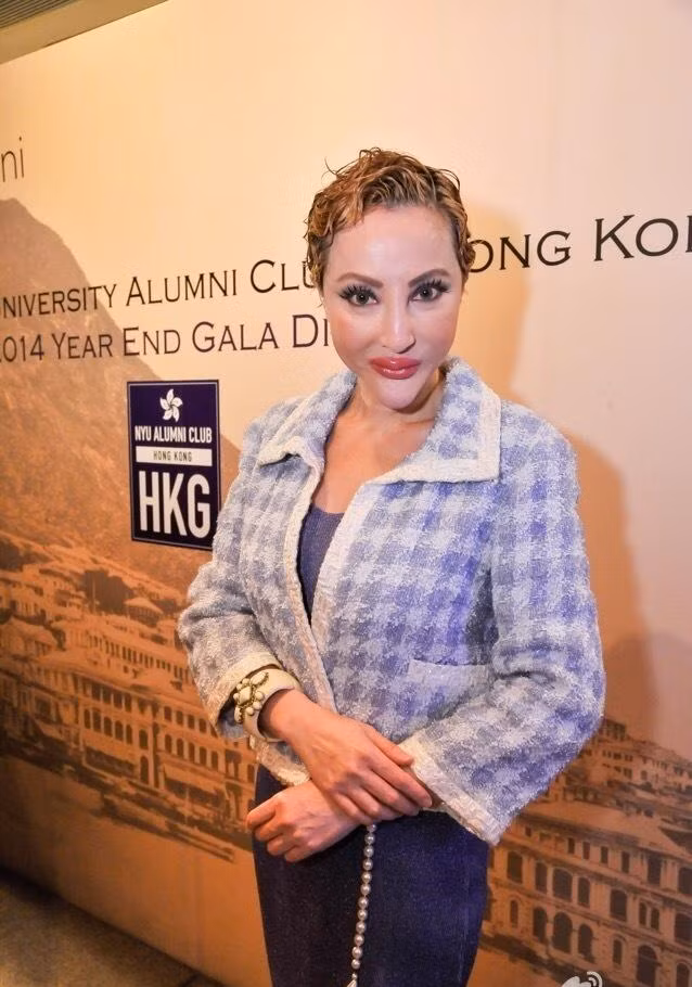 Một trường hợp lạm dụng phẫu thuật thẩm mỹ nữa là Tiết Chỉ Luân. Nữ diễn viên gạo cội của xứ Cảng Thơm khiến người hâm mộ sợ hãi vì gương mặt biến dạng của mình.