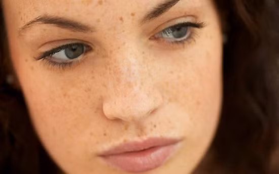 Không ăn thịt bò khi đang trị tàn nhang, nám. Thịt bò là loại chứa nhiều protein và nếu trong quá trình trị nám hoặc tàn nhang nên kiêng loại thịt này bởi nó sẽ khiến những nốt nám, tàn nhang lây lan nhanh hơn.