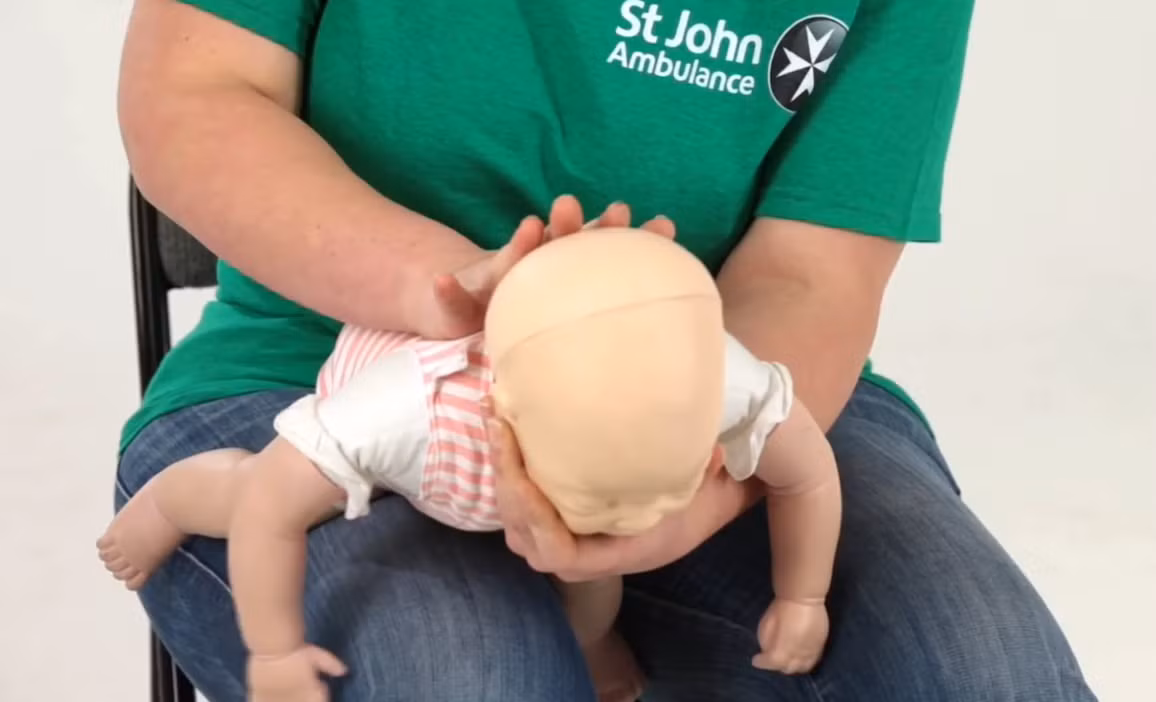 Sơ cứu hóc dị vật cho trẻ bằng cách vỗ mạnh vào lưng trẻ.