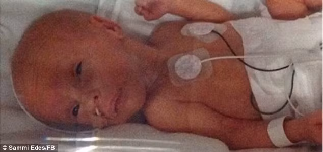 Tôi muốn chia sẻ hình ảnh này đến tất cả các bạn để nói rằng, các bà mẹ hãy can đảm và kiên trì với sự sống của con mình, dù chỉ là phần trăm rất nhỏ”.