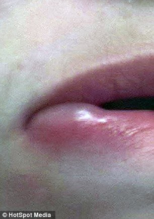 “Tôi cố gắng sống một cuộc sống bình thường và không ảnh hưởng đến mọi người trong gia đình nhưng vào mùa hè điều đó rất khó. Tôi không bao giờ mơ đến việc đi nghỉ ở nước ngoài hoặc phơi mình trên bãi biển. Các con tôi hiện giờ gọi tôi bằng biệt hiệu là ma cà rồng”.