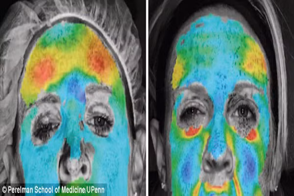 Xem hinh anh 3D tac dong cua botox den mat-Hinh-3