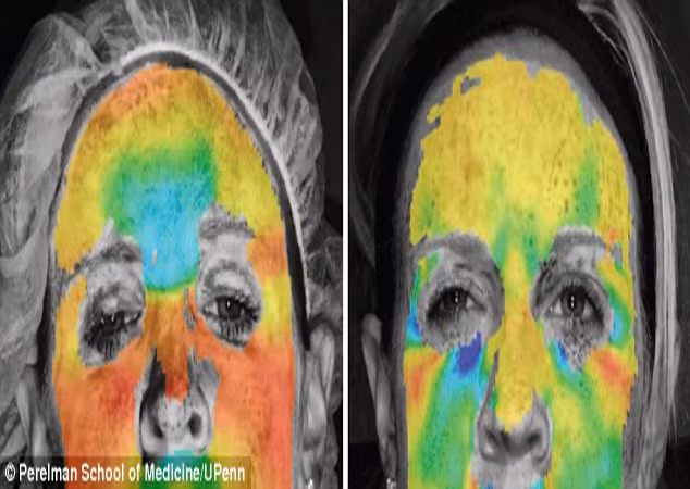 Xem hinh anh 3D tac dong cua botox den mat-Hinh-2