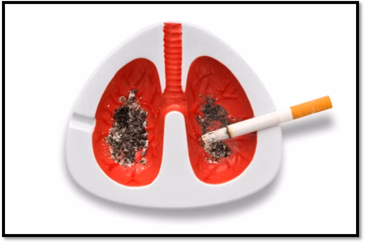 Phổi. Theo thống kê, đây là loại ung thư gây tử vong hàng đầu ở nam giới. Khi đã mắc ung thư phổi rất khó chữa và nguyên nhân gây ung thư phổi thì luôn tiềm ẩn quanh chúng ta. Khoảng 90% các trường hợp mắc ung thư phổi là do thuốc lá.