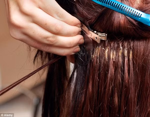 Dòi chui từ mối nối tóc. Irene Myangoh, người Kenya đã nối tóc lọn xoăn tại một hiệu làm đầu. Tuy nhiên, chỉ sau 2 tuần, chị Irene bị đau đầu dữ dội. Sau đó, mặc dù chị có sử dụng thuốc giảm đau nhưng triệu chứng vẫn không thuyên giảm là bao.