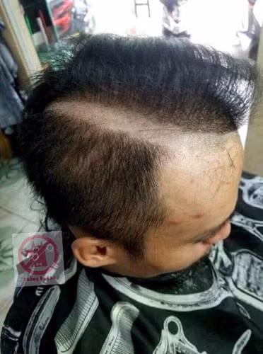 Tóc trước khi vào tiệm chỉ thưa thôi, giờ cắt xong muốn hói luôn đây này!