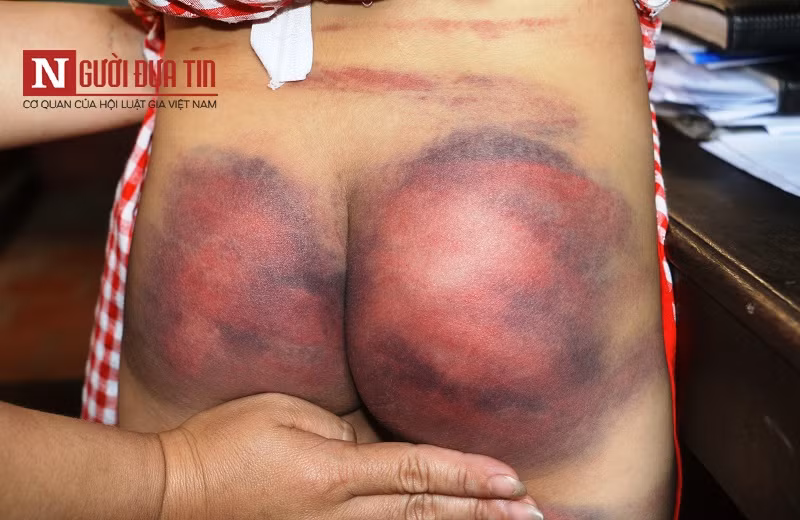 Vu be gai 8 tuoi bi bo troi vao cot nha, bao hanh: Bat ngo chia se cua ba noi-Hinh-3