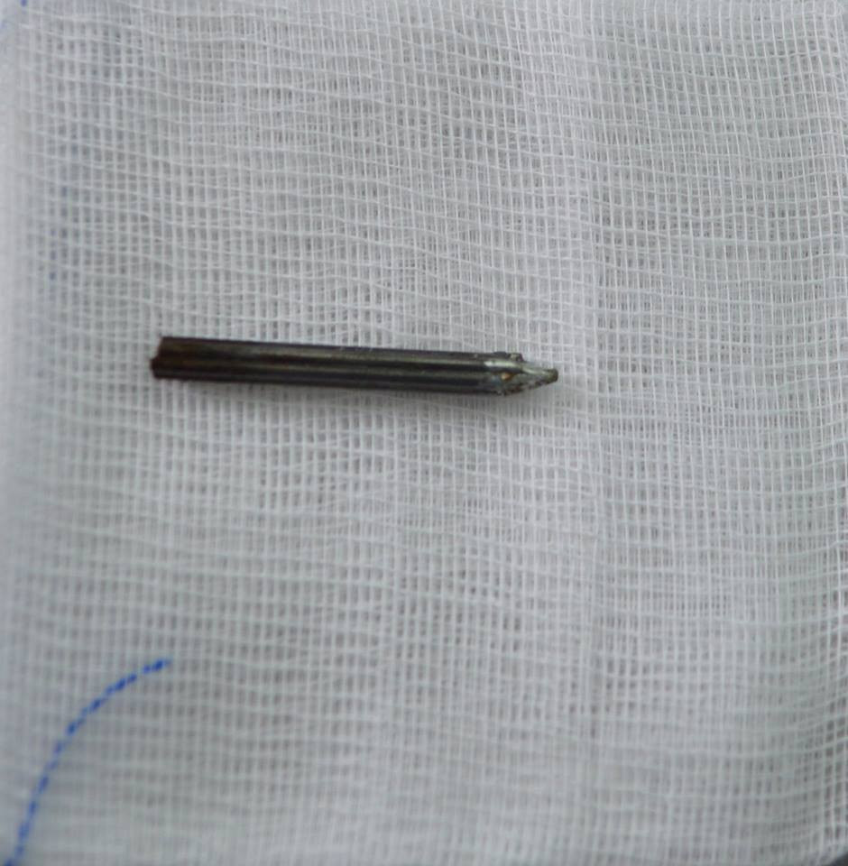 Sua nha don Tet, nam thanh nien gap tai nan hy huu-Hinh-3