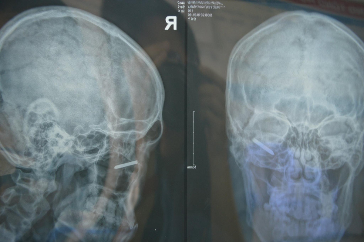 Sua nha don Tet, nam thanh nien gap tai nan hy huu-Hinh-2