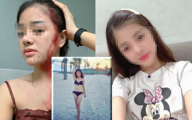  2. Vợ đẹp như hot girl bị chồng đánh chảy máu đầu: Khoảng đầu tháng 4/2019, hot girl Hoàng Hải Yến bất ngờ đăng ảnh cho thấy máu chảy từ đầu xuống cổ kèm theo chú thích: “Lưu lại ngày hôm nay, sẽ không oán trách, bởi có trách thì trách bản thân quá nhu nhược, quá mù quáng và ngu!”.