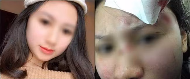 Hỏi về nguyên nhân chị V. cho biết: "Hôm đó, con lớn nhà tôi bị đau mắt, tôi nhỏ thuốc mắt thì con sợ quá nên khóc ầm ĩ, anh ta thấy vậy cáu nên đánh con. Mà tính tôi xưa nay không muốn con bị đánh nên có lời qua tiếng lại.