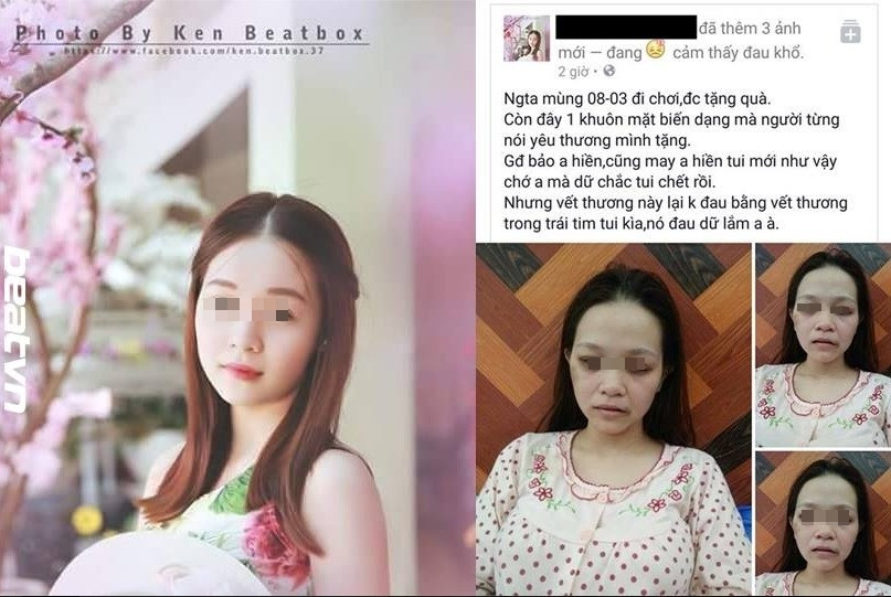  5. Vợ hotgirl mang bầu mặt mũi “bầm dập” vì bị chồng đánh, ngày 7/3/2016, trên mạng xã hội chia sẻ một bài viết của cô vợ xinh như hotgirl bị chồng đánh đập khi gần đến ngày 8/3 khiến dân mạng tỏ ra vô cùng thương xót.