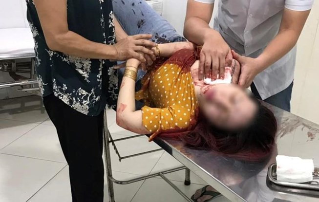 Dang an sang, nguoi phu nu bat ngo bi dam nhieu nhat vao co