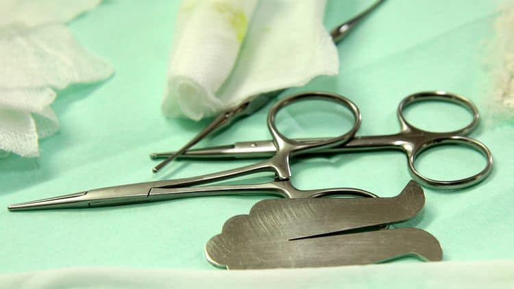 Cu ong 70 bi “de ra” cat bao quy dau va cai ket bat ngo