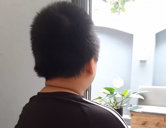 Be trai 12 tuoi nghi bi bo, di ghe bao hanh: Da co ket qua giam dinh-Hinh-2