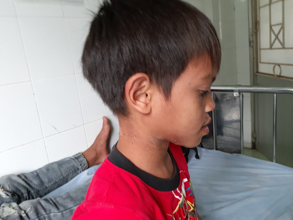 Nguoi Trung Quoc xuat hien o Tay Nguyen mua con trung gia cao gay xon xao-Hinh-3