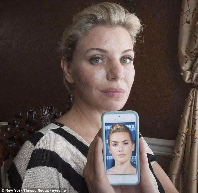 Khi fan cuong phau thuat tham my de giong sao-Hinh-10